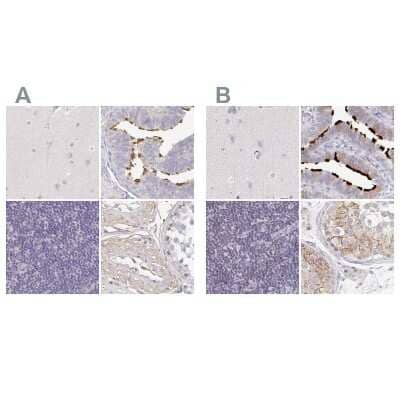 Immunohistochemistry-Paraffin: TXNDC6 Antibody [NBP2-48719] - Staining of human cerebral cortex, fallopian tube, lymph node and testis using Anti-NME9 antibody NBP2-48719 (A) shows similar protein distribution across tissues to independent antibody NBP2-48802 (B).