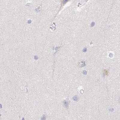 Immunohistochemistry-Paraffin: TXNDC6 Antibody [NBP2-48719] - Staining of human cerebral cortex.