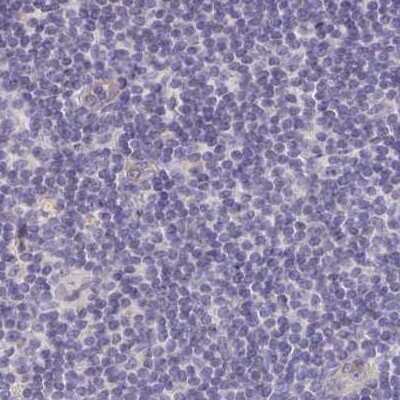 Immunohistochemistry-Paraffin: TXNDC6 Antibody [NBP2-48719] - Staining of human lymph node.