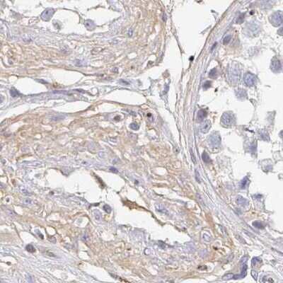 Immunohistochemistry-Paraffin: TXNDC6 Antibody [NBP2-48719] - Staining of human testis.