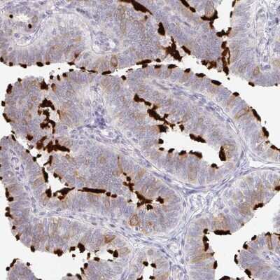 Immunohistochemistry-Paraffin: TXNDC6 Antibody [NBP2-48802] - Staining of human fallopian tube shows high expression.