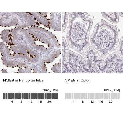 <b>Orthogonal Strategies Validation. </b>Immunohistochemistry-Paraffin: TXNDC6 Antibody [NBP2-48802] - Staining in human fallopian tube and colon tissues using anti-NME9 antibody. Corresponding NME9 RNA-seq data are presented for the same tissues.