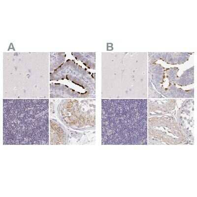 <b>Independent Antibodies Validation. </b>Immunohistochemistry-Paraffin: TXNDC6 Antibody [NBP2-48802] - Staining of human cerebral cortex, fallopian tube, lymph node and testis using Anti-NME9 antibody NBP2-48802 (A) shows similar protein distribution across tissues to independent antibody NBP2-48719 (B).