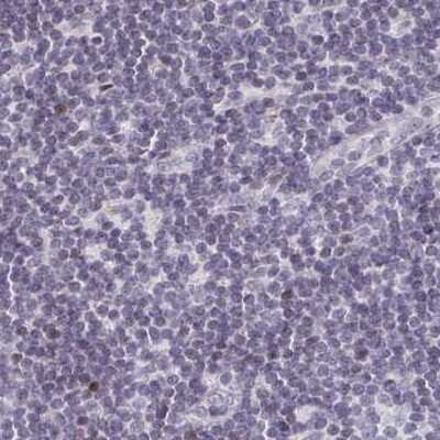 Immunohistochemistry-Paraffin: TXNDC6 Antibody [NBP2-48802] - Staining of human lymph node.