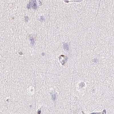 Immunohistochemistry-Paraffin: TXNDC6 Antibody [NBP2-48802] - Staining of human cerebral cortex.