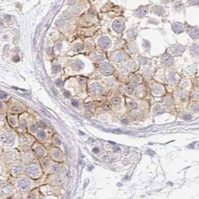 Immunohistochemistry-Paraffin: TXNDC6 Antibody [NBP2-48802] - Staining of human testis.