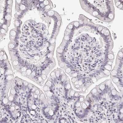 Immunohistochemistry-Paraffin: TXNDC6 Antibody [NBP2-48802] - Staining of human colon shows low expression as expected.