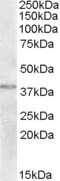 Western Blot: TXNDC6 Antibody [NBP1-20993] - Analysis of TXNDC6 in Human Uterus lysate (35ug protein in RIPA buffer) using NBP1-20993 at 2ug/ml. Primary incubation was 1 hour. Detected by chemiluminescence.