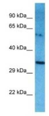 Western Blot: TXNDC6 Antibody [NBP3-09902] - Western blot analysis of TXNDC6 in A549 Whole Cell lysates. Antibody dilution at 1.0ug/ml