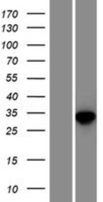 Western Blot: TXNDC6 Overexpression Lysate (Adult Normal) [NBP2-04967] Left-Empty vector transfected control cell lysate (HEK293 cell lysate); Right -Over-expression Lysate for TXNDC6.