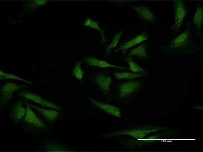 Immunocytochemistry/Immunofluorescence: TXNDC9 Antibody [H00010190-B01P] - Analysis of purified antibody to TXNDC9 on HeLa cell. (antibody concentration 10 ug/ml)