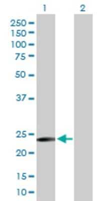 Western Blot: TXNDC9 Antibody [H00010190-D01P] - Analysis of TXNDC9 expression in transfected 293T cell line by TXNDC9 polyclonal antibody.Lane 1: TXNDC9 transfected lysate(22.20 KDa).Lane 2: Non-transfected lysate.