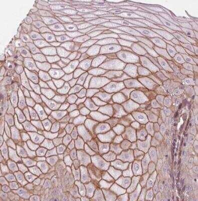 Immunohistochemistry-Paraffin: TXNIP Antibody [NBP2-49095] - Staining of human cervix, uterine shows strong membranous positivity in squamous epithelial cells.