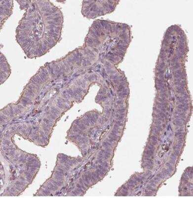 Immunohistochemistry-Paraffin: TXNIP Antibody [NBP2-49095] - Staining of human fallopian tube shows moderate membranous positivity in glandular cells.