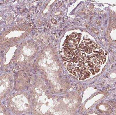 Immunohistochemistry-Paraffin: TXNIP Antibody [NBP2-49095] - Staining of human kidney shows strong membranous positivity in cells in glomeruli.