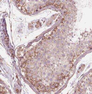 Immunohistochemistry-Paraffin: TXNIP Antibody [NBP2-49095] - Staining of human testis shows moderate membranous positivity in cells in seminiferous ducts.
