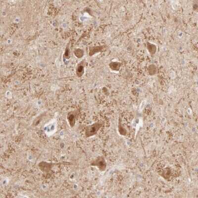 Immunohistochemistry-Paraffin: TXNL1 Antibody [NBP1-86899] - Staining of human hippocampus shows moderate nuclear and cytoplasmic immunoreactivity in neurons.