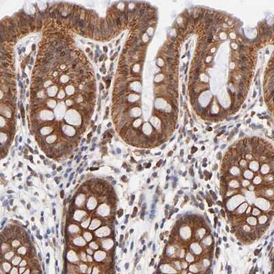 Immunohistochemistry-Paraffin: TXNL1 Antibody [NBP1-86899] - Staining of human colon shows strong cytoplasmic and membranous positivity in glandular cells.