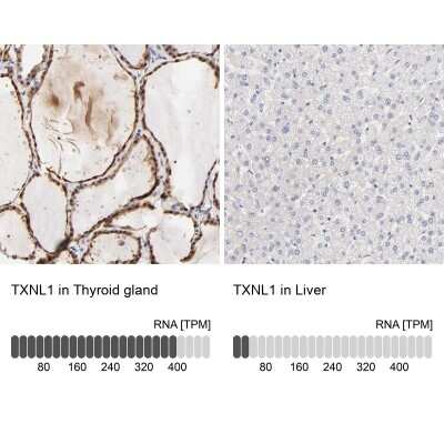 Immunohistochemistry-Paraffin: TXNL1 Antibody [NBP1-86900] - Analysis in human thyroid gland and liver tissues using NBP1-86900 antibody. Corresponding TXNL1 RNA-seq data are presented for the same tissues.