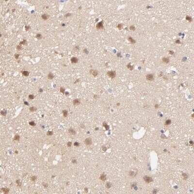 Immunohistochemistry-Paraffin: TXNL1 Antibody [NBP1-86900] - Staining of human Cerebral cortex shows moderate cytoplasmic and nuclear positivity in neuronal cells.