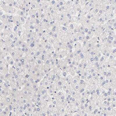 Immunohistochemistry-Paraffin: TXNL1 Antibody [NBP1-86900] - Staining of human liver shows very weak cytoplasmic positivity in hepatocytes.