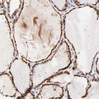 Immunohistochemistry-Paraffin: TXNL1 Antibody [NBP1-86900] - Staining of human Thyroid gland shows strong cytoplasmic and nuclear positivity in glandular cells.