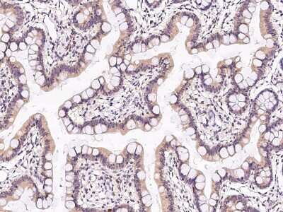 Immunohistochemistry-Paraffin: TXNL1 Antibody [NBP2-99643] - Immunochemical staining TXNL1 in human small intestine with rabbit polyclonal antibody at 1:300 dilution, formalin-fixed paraffin embedded sections.