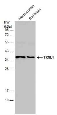 Western Blot: TXNL1 Antibody [NBP3-13213] - Various tissue extracts (10 ug) were separated by 12% SDS-PAGE, and the membrane was blotted with TXNL1 antibody (NBP3-13213) diluted at 1:1000.