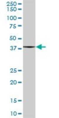 Western Blot: Glutaredoxin 3/GLRX3 Antibody [H00010539-B01P] - Analysis of GLRX3 expression in human spleen.