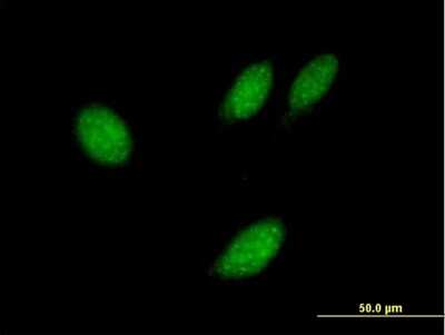 Immunocytochemistry/Immunofluorescence: TXNL4B Antibody [H00054957-B02P] - Analysis of purified antibody to TXNL4B on HeLa cell. (antibody concentration 10 ug/ml)