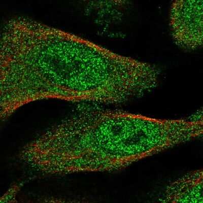 Immunocytochemistry/Immunofluorescence: TXNL4B Antibody [NBP2-57584] - Staining of human cell line U-2 OS shows localization to nucleoplasm & cytosol.