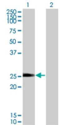 Western Blot: TXNL6 Antibody (7H3) [H00115861-M01] - Analysis of NXNL1 expression in transfected 293T cell line by TXNL6 monoclonal antibody (M01), clone 7H3.Lane 1: NXNL1 transfected lysate(23.9 KDa).Lane 2: Non-transfected lysate.
