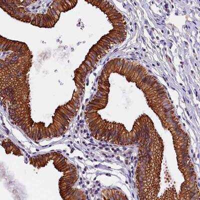 Immunohistochemistry-Paraffin TXNL6 Antibody