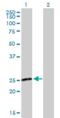 Western Blot: TXNL6 Antibody [H00115861-B01P] - Analysis of NXNL1 expression in transfected 293T cell line by NXNL1 polyclonal antibody.  Lane 1: NXNL1 transfected lysate(23.32 KDa). Lane 2: Non-transfected lysate.
