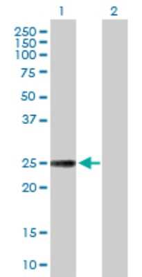 Western Blot: TXNL6 Antibody [H00115861-D01P] - Analysis of NXNL1 expression in transfected 293T cell line by NXNL1 polyclonal antibody.Lane 1: NXNL1 transfected lysate(23.90 KDa).Lane 2: Non-transfected lysate.