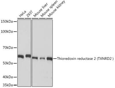 Western Blot: TXNRD2 Antibody (4O1K0) [NBP3-16715] - Western blot analysis of extracts of various cell lines, using Thioredoxin reductase 2 (TXNRD2 ) Rabbit mAb (NBP3-16715) at 1:1000 dilution. Secondary antibody: HRP Goat Anti-Rabbit IgG (H+L) at 1:10000 dilution. Lysates/proteins: 25ug per lane. Blocking buffer: 3% nonfat dry milk in TBST. Detection: ECL Basic Kit. Exposure time: 10s.