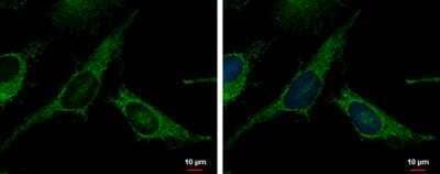 Immunocytochemistry/Immunofluorescence: TXNRD2 Antibody [NBP2-20768] - TXNRD2 antibody detects TXNRD2 protein at mitochondria by immunofluorescent analysis. Sample: HeLa cells were fixed in 2% paraformaldehyde/culture medium at 37C for 30 min. Green: TXNRD2 protein stained by TXNRD2 antibody diluted at 1:500. Blue: Hoechst 33342 staining.