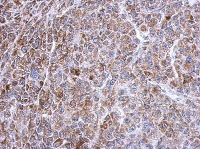 Immunohistochemistry-Paraffin: TXNRD2 Antibody [NBP2-20768] - Immunohistochemical analysis of paraffin-embedded HBL435 xenograft, using antibody at 1:500 dilution.