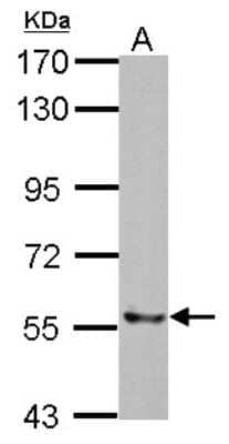 Western Blot: TXNRD2 Antibody [NBP2-20768] - Sample (30 ug of whole cell lysate) A: HepG2 7. 5% SDS PAGE gel, diluted at 1:1000.