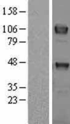 Western Blot: TYRO3 Overexpression Lysate (Adult Normal) [NBL1-17482] Left-Empty vector transfected control cell lysate (HEK293 cell lysate); Right -Over-expression Lysate for TYRO3.