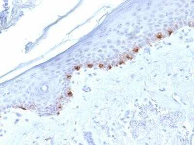 Immunohistochemistry-Paraffin: TYRP1 Antibody (TYRP1/1986) - Azide and BSA Free [NBP2-61600] - Formalin-fixed, paraffin-embedded human Skin stained withTYRP1 Mouse Monoclonal Antibody (TYRP1/1986)