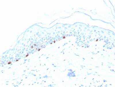 Immunohistochemistry-Paraffin: TYRP1 Antibody (TYRP1/3280) - Azide and BSA Free [NBP2-79926] - Formalin-fixed, paraffin-embedded human Skin stained with TYRP1-Monospecific Mouse Monoclonal Antibody (TYRP1/3280).