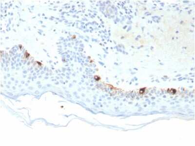 Immunohistochemistry-Paraffin: TYRP1 Antibody (TYRP1/3281) [NBP3-08897] - Formalin-fixed, paraffin-embedded human Skin stained with TYRP1-Monospecific Mouse Monoclonal Antibody (TYRP1/3281).