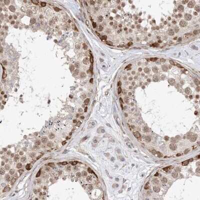 Immunohistochemistry-Paraffin: TYSND1 Antibody [NBP1-93484] - Staining of human testis shows cytoplasmic positivity in cells in seminiferous ducts.