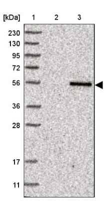 Western Blot: TYSND1 Antibody [NBP1-93484] - Lane 1: Marker  [kDa] 230, 130, 95, 72, 56, 36, 28, 17, 11.  Lane 2: Human cell line RT-4.  Lane 3: Human cell line U-251MG sp