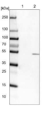 Western Blot: TYSND1 Antibody [NBP1-93484] - Lane 1: NIH-3T3 cell lysate (Mouse embryonic fibroblast cells), Lane 2: NBT-II cell lysate (Rat Wistar bladder tumour cells)
