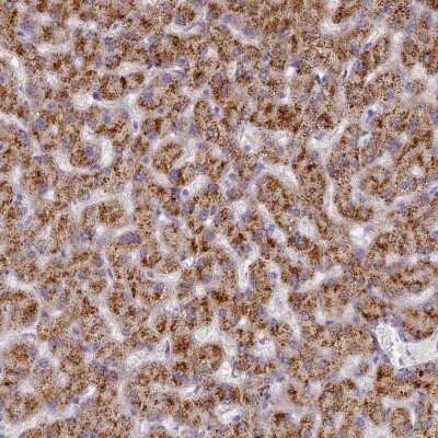 Immunohistochemistry: TYW1 Antibody [NBP2-38128] - Staining of human liver shows strong cytoplasmic positivity in hepatocytes.