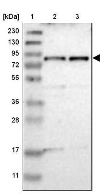 Western Blot: TYW1 Antibody [NBP2-38128] - Lane 1: Marker  [kDa] 230, 130, 95, 72, 56, 36, 28, 17, 11.  Lane 2: Human cell line RT-4.  Lane 3: Human cell line U-251MG