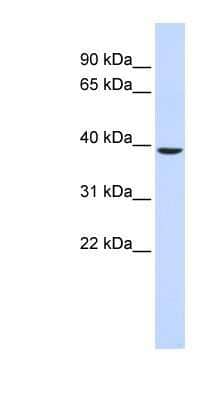 Western Blot: TYW5 Antibody [NBP1-91416] - Human Muscle lysate, concentration 0.2-1 ug/ml.