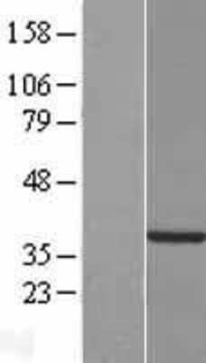 Western Blot: TYW5 Overexpression Lysate (Adult Normal) [NBP2-08544] Left-Empty vector transfected control cell lysate (HEK293 cell lysate); Right -Over-expression Lysate for TYW5.